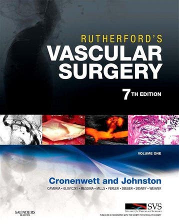 Rutherfords Vascular Surgery, 2-Volume Set - Jack, Verzenden, Gelezen, Jack Cronenwett