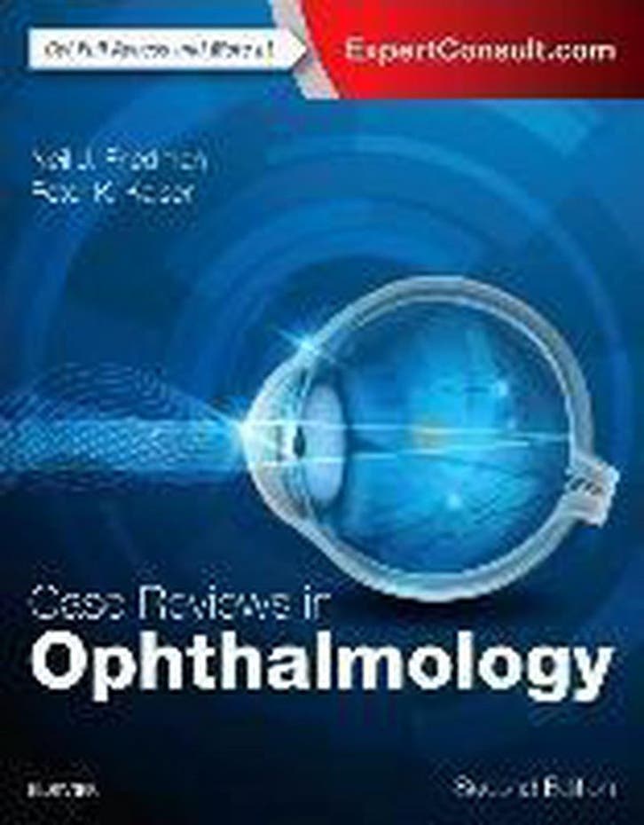 Case Reviews in Ophthalmology Boek, Boeken, Overige Boeken, Verzenden