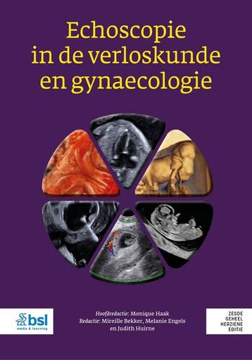 9789036830348 Echoscopie in de verloskunde en gynaecologie, Boeken, Verzenden, Nieuw
