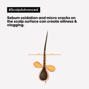 L'Oréal Professionnel SE Scalp Advanced Dermo-purifi.., Verzenden, Nieuw