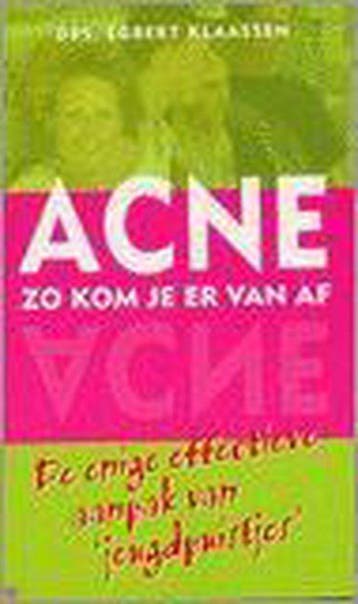 Acne Zo Kom Je Er Van Af - Klaassen, Verzenden, Gelezen