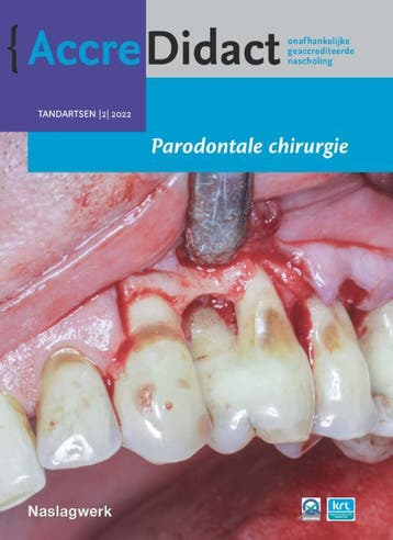 Parodontale chirurgie / AccreDidact / 2022/2 9789089764577, Verzenden, Zo goed als nieuw, Alexander Verhelst