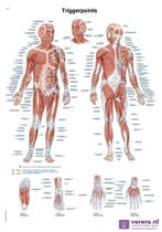 Anatomie poster triggerpoints (Nederlands/Latijn, papier..., Nieuw