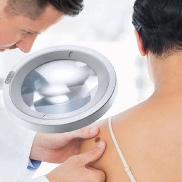 Loeparmatuur OPTICLUX Optie Woodlamp D med opticlux 10-1 P, Verzenden, Nieuw