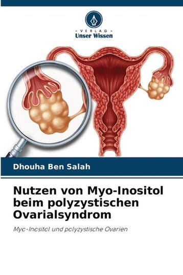 9786205300947 Nutzen von Myo-Inositol beim polyzystischen..., Verzenden, Nieuw, Dhouha Ben Salah