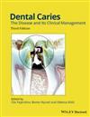 Dental Caries, 9781118935828, Boeken, Verzenden, Zo goed als nieuw, HBO