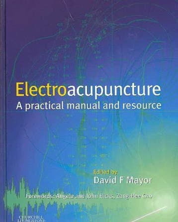 Electroacupuncture 9780443063695, Boeken, Techniek, Zo goed als nieuw