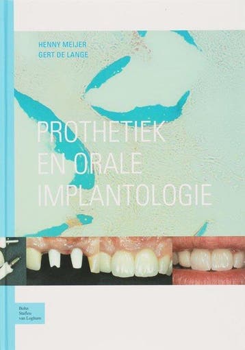 9789031341436 Prothetiek en orale implantologie, Boeken, Verzenden, Zo goed als nieuw, H. Meijer