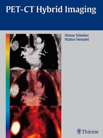 PET-CT Hybrid Imaging - Otmar Schober 9783131488619, Verzenden, Zo goed als nieuw, Otmar Schober