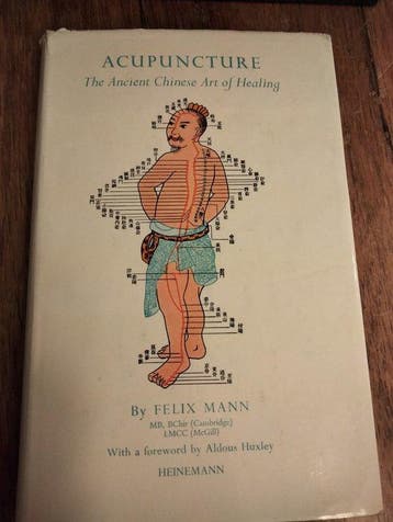 Acupuncture: The Ancient Chinese Art of Healing, Verzenden, Gelezen