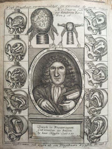 Hendrik van Deventer - [OBSTETRICS, MANY PRINTS] Manuale
