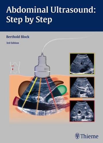 9783131383631 Abdominal Ultrasound: Step by Step, Boeken, Verzenden, Nieuw, Berthold Block