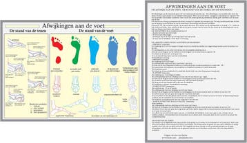 Anatomie poster voet en voetafwijkingen (Nederlands, gel..., Nieuw