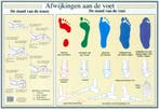 Anatomie poster voet en voetafwijkingen (Nederlands, gel..., Nieuw