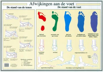 Anatomie poster voet en voetafwijkingen (Nederlands, gel..., Nieuw