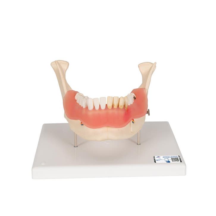 Anatomie model tandziekten, 21-delig, 18x26x19 cm, Sport en Fitness, Massageproducten