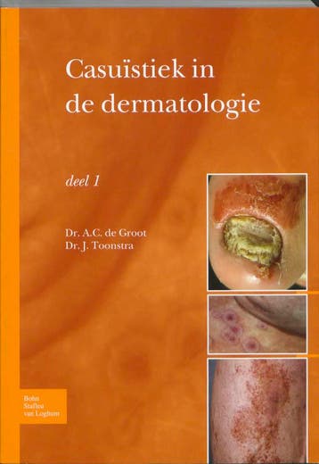 Casuïstiek in de dermatologie / deel 1 9789031361885, Verzenden, Gelezen, Johan Toonstra