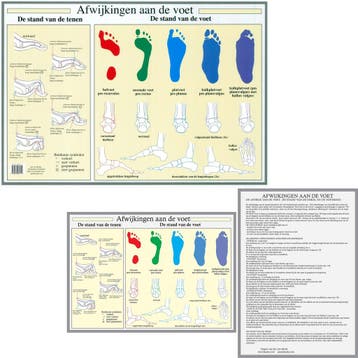 Anatomie poster voet en voetafwijkingen (Nederlands, gel..., Nieuw