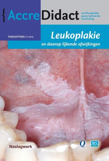 Leukoplakie en daarop lijkende afwijkingen / AccreDidact /, Verzenden, Zo goed als nieuw, Isaäc van der Waal