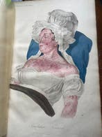 (Baron J.L.) Alibert - [Giant folio] Clinique de lHôpital