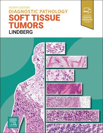 9780443109362 Diagnostic Pathology: Soft Tissue Tumors, Verzenden, Nieuw, Matthew Lindberg