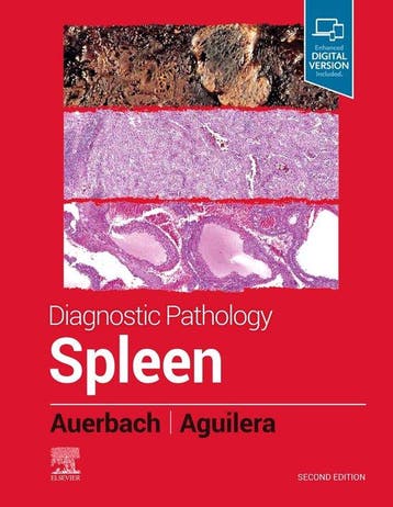 9780323830126 Diagnostic Pathology: Spleen, Verzenden, Nieuw, Aaron Auerbach