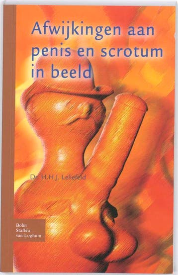 Afwijkingen aan penis en scrotum in beeld - Leliefeld, Verzenden, Gelezen, Leliefeld