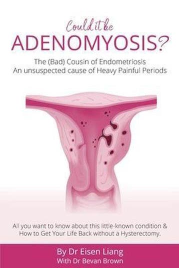 9781925471564 Adenomyosis -The Bad Cousin of Endometriosis, Verzenden, Nieuw, EISEN LIANG