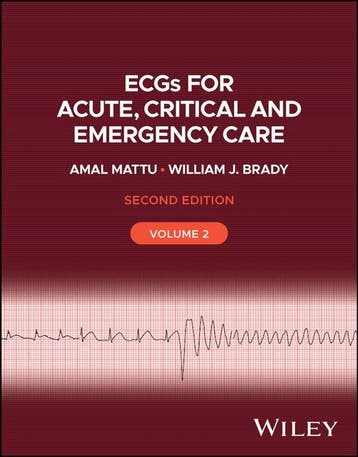 9781119986287 ECGs for Acute, Critical and Emergency Care..., Verzenden, Nieuw, Amal Mattu
