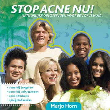 Stop acne nu! - M.Y. Horn 9789078923039, Verzenden, Gelezen, M.Y. Horn