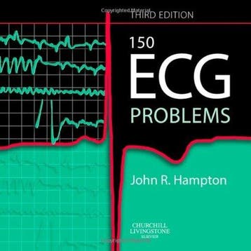 150 ECG Problems - John Hampton 9780443068232, Boeken, Verzenden, Zo goed als nieuw, John Hampton