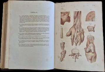 Dr. Étienne Lancereaux / Lackerbauer - Atlas de Anatomía, Antiek en Kunst
