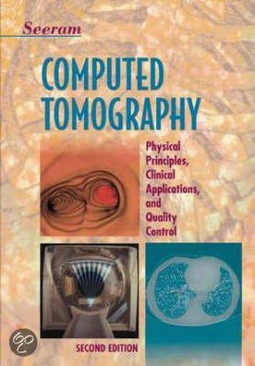 Computed Tomography - Sean Chen 9780721681733, Verzenden, Gelezen, Sean Chen