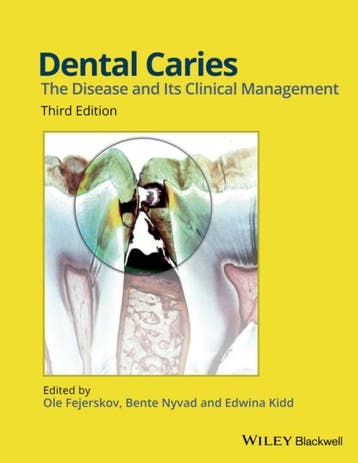Dental Caries 9781118935828, Boeken, Zo goed als nieuw
