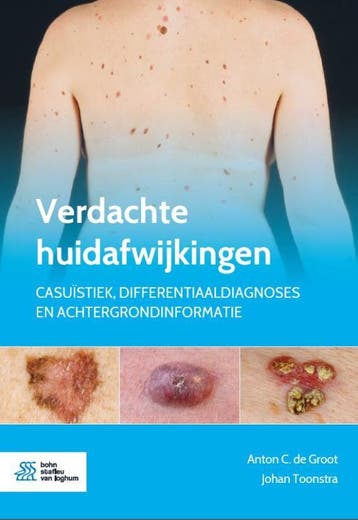Verdachte huidafwijkingen 9789036824668 Anton  C. de Groot, Verzenden, Zo goed als nieuw, Anton  C. de Groot