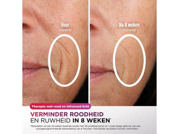 Shark CryoGlow - LED-Masker - Onder-Oog Koeling + LED, Verzenden, Nieuw