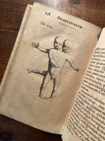 Nicolas Tulp - Observationum Medicarum Libri Tres cum aenis