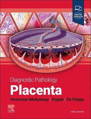 9780443116544 Diagnostic Pathology- Diagnostic Pathology:..., Verzenden, Nieuw, Amy Heerema-Mckenney