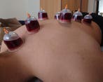 Hjjama/Wet Cupping, Cupping Massage & Dry Cupping, Komt aan huis, Overige