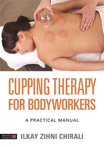 9781848193574 Cupping Therapy for Bodyworkers: A Practica..., Boeken, Verzenden, Nieuw, Ilkay Zihni Chirali