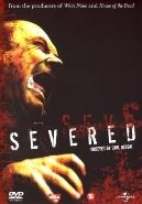 Severed - DVD, Verzenden, Nieuw in verpakking