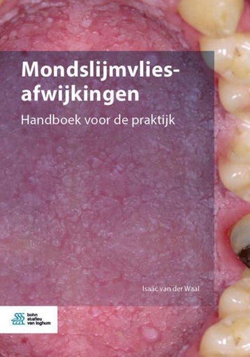 9789036824019 Mondslijmvliesafwijkingen | Tweedehands, Verzenden, Zo goed als nieuw, Isaac van der Waal