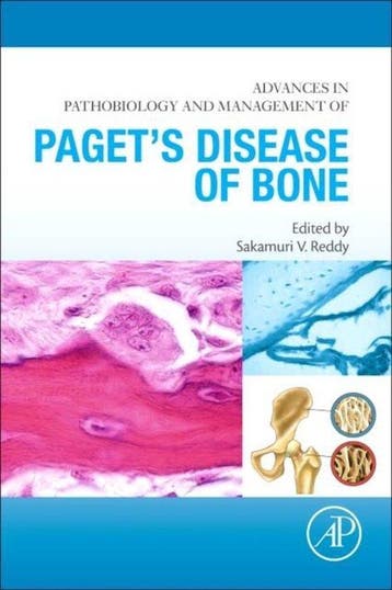 Boek Advances In Pathobiology & Management 9780128050835, Verzenden, Zo goed als nieuw