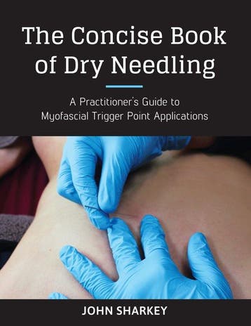 9781623170837 The Concise Book of Dry Needling, Verzenden, Nieuw, John Sharkey