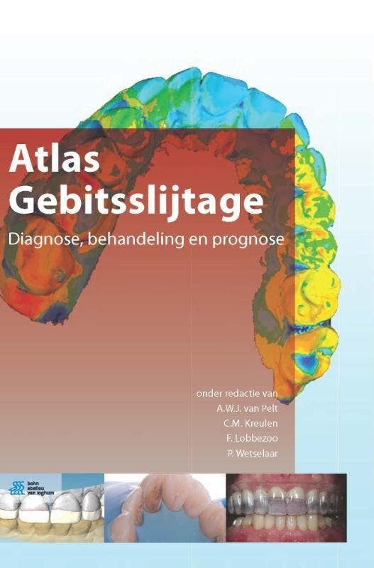 Atlas gebitsslijtage 9789036805377, Boeken, Wetenschap, Zo goed als nieuw, Verzenden