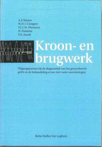 Kroon  en brugwerk 9789031350049, Boeken, Verzenden, Zo goed als nieuw