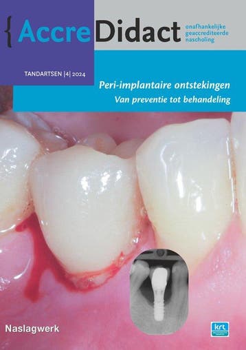 9789089765420 AccreDidact TA2024/4 - Peri-implantaire ont..., Verzenden, Nieuw, Yvonne de Waal