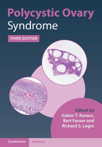 Polycystic Ovary Syndrome - Gabor T. Kovacs 9781108839334, Boeken, Verzenden, Zo goed als nieuw, Gabor T. Kovacs