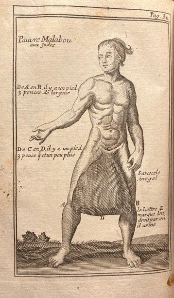 Pierre Dionis - Cours d’opérations de chirurgie - 1751