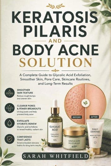 9798180483294 Keratosis Pilaris and Body Acne Solution, Verzenden, Nieuw, Sarah Whitfield